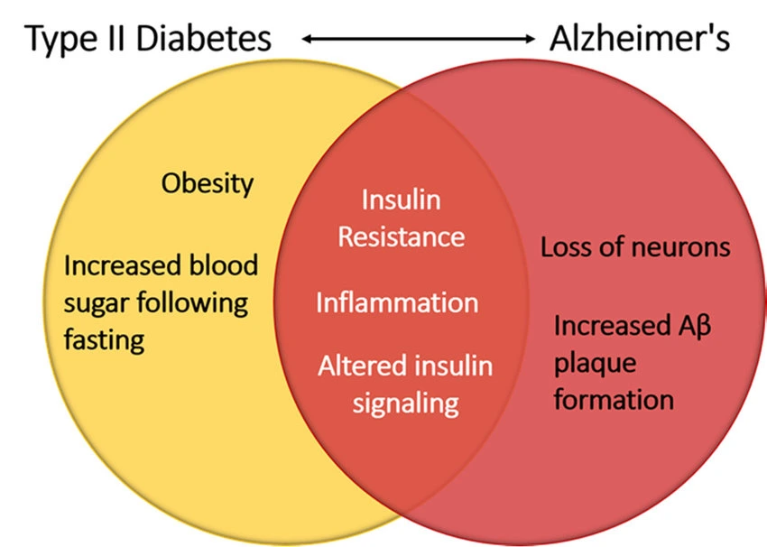 diabetes and alzheimer's