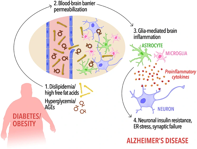 diabetes and alzheimer's risk